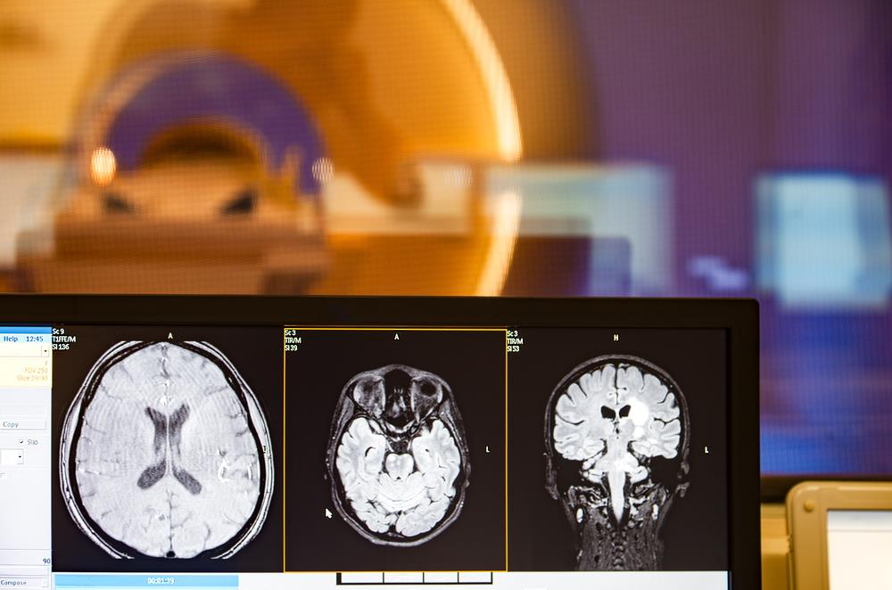 Tomograph brain head scan scanner MRI monitor